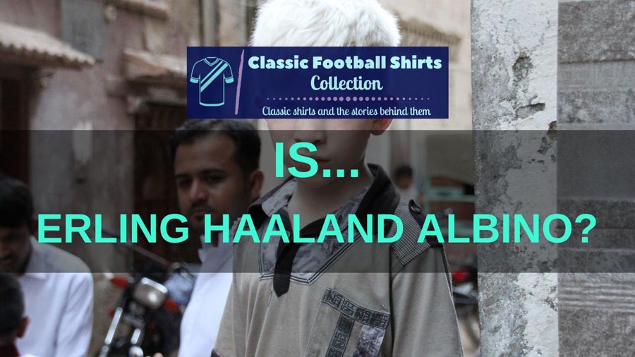Is Erling Haaland Albino? (Explained)